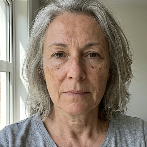 Before - Linda, 63
